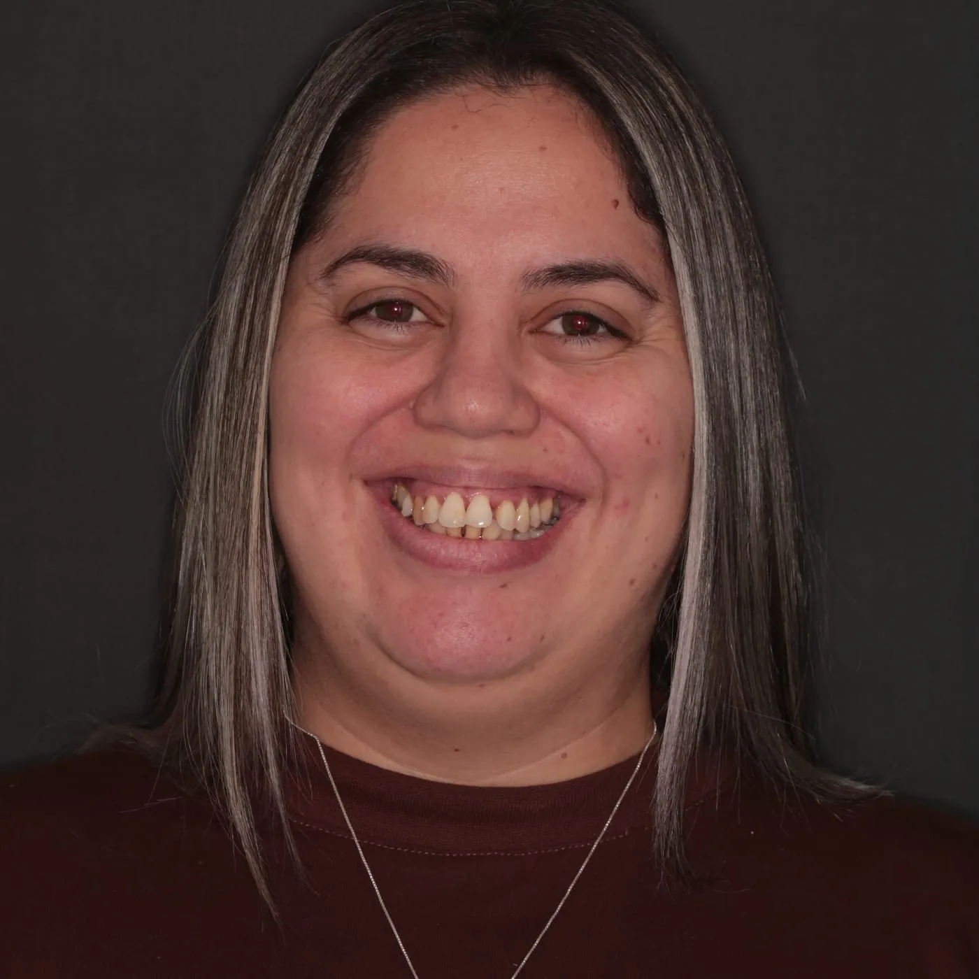 Carol antes, Reabilitação Estética